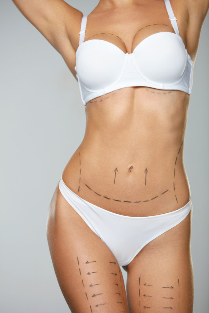 How Long Will My Breasts Be Swollen + 5 More Questions You Have About Breast  Augmentation Recovery - Dr. Movassaghi